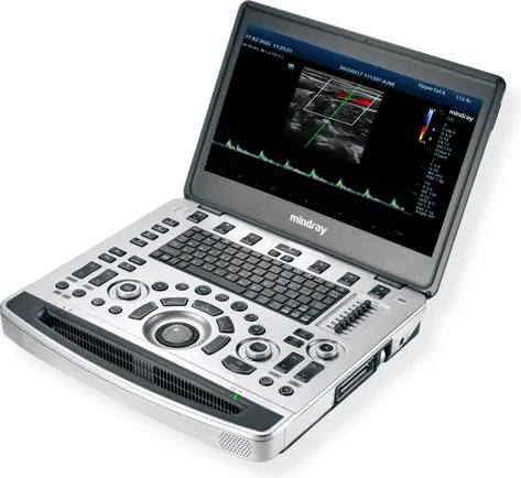Ultrasonido portatil Mindray M9