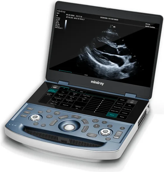 Ultrasonido portatil Mindray