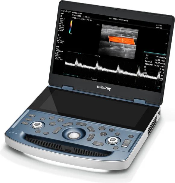Ultrasonido portatil Mindray MX7